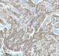 Anti-GCLM Rabbit Monoclonal Antibody